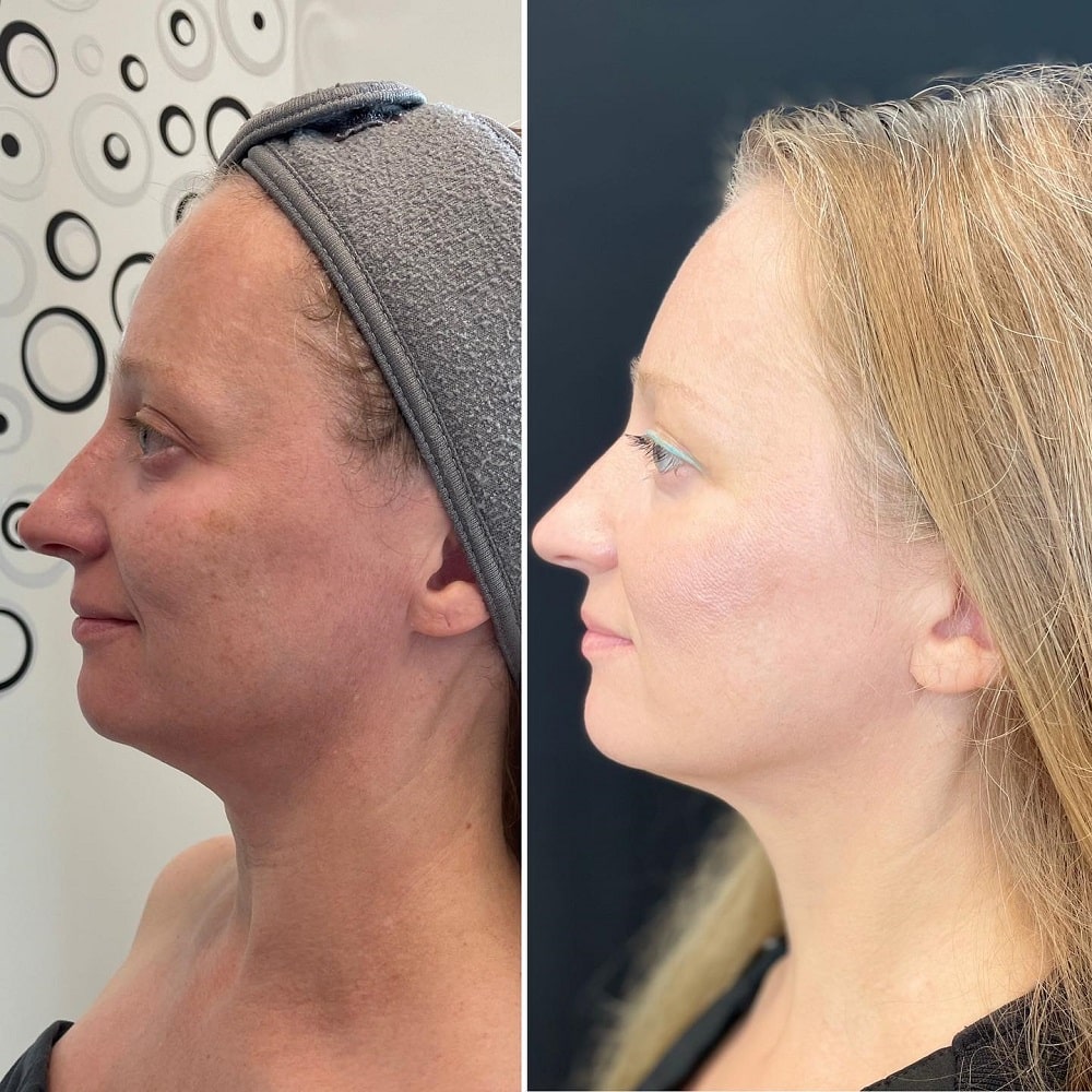 Facial2 (1)