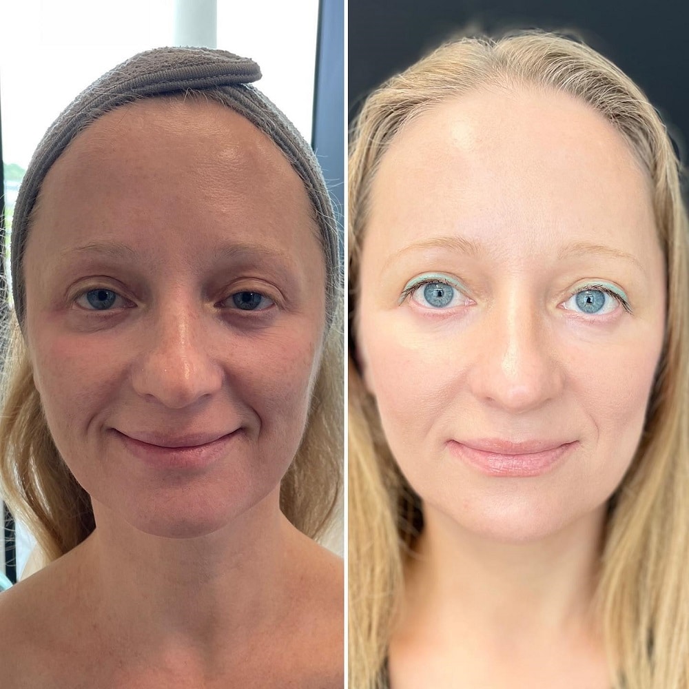 Facial2 (2)